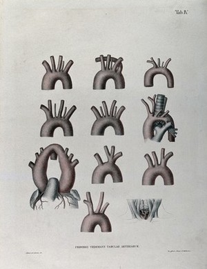 view The aortic arch and the arteries of the neck: eleven figures. Coloured lithograph by J. Roux, 1822.