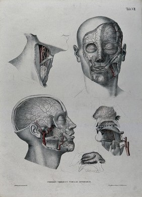 Dissections of the face, neck and jaw: five figures, with the arteries and blood vessels indicated in red. Coloured lithograph by J. Roux, 1822.