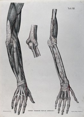 Dissections of the arm, hand and elbow joint; three figures, with the blood vessels indicated in red. Coloured lithograph by J. Roux, 1822.