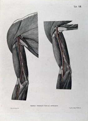 Dissections of the shoulder and arm; two figures, with the arteries and blood vessels indicated in red. Coloured lithograph by J. Roux, 1822.