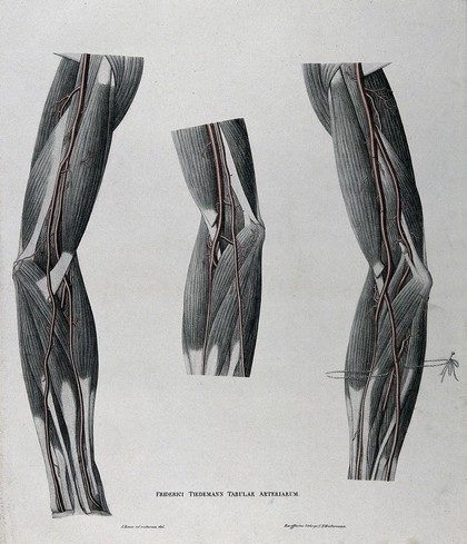 Dissections of the arm and elbow; three figures, with the arteries and blood vessels indicated in red. Coloured lithograph by J. Roux, 1822.