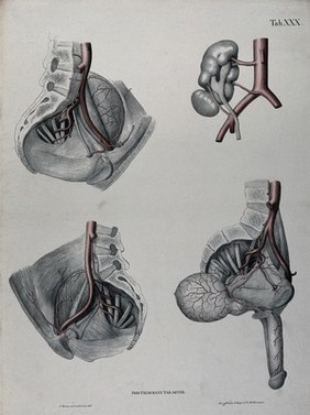 Dissections of the male urogenital system and pelvic region: four figures, with the arteries and blood vessels indicated in red. Coloured lithograph by J. Roux, 1822.