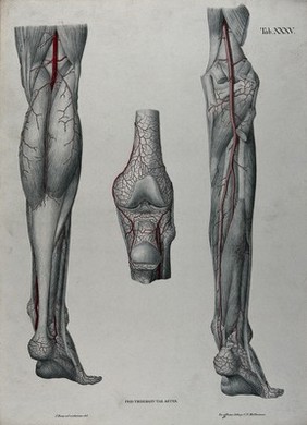 Dissections of the lower leg, knee joint and foot, back view: three figures, with the arteries and blood vessels indicated in red. Coloured lithograph by J. Roux, 1822.