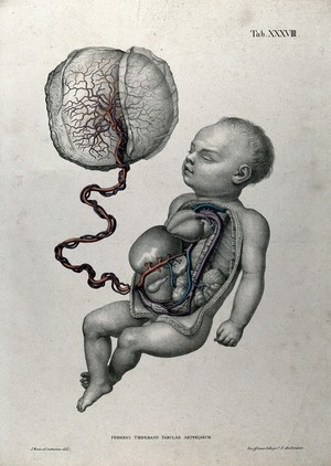 view A baby, with thorax and abdomen dissected, attached by umbilical cord to the placenta, with the arteries, blood vessels and veins indicated in red. Coloured lithograph by J. Roux, 1822.