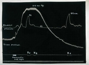 view Response of blood pressure and bladder pressure to a dose of 0.65 milligrams of adrenaline: kymograph image. Drawing, ca. 1920.