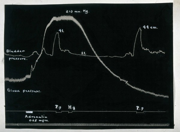 Response of blood pressure and bladder pressure to a dose of 0.65 milligrams of adrenaline: kymograph image. Drawing, ca. 1920.