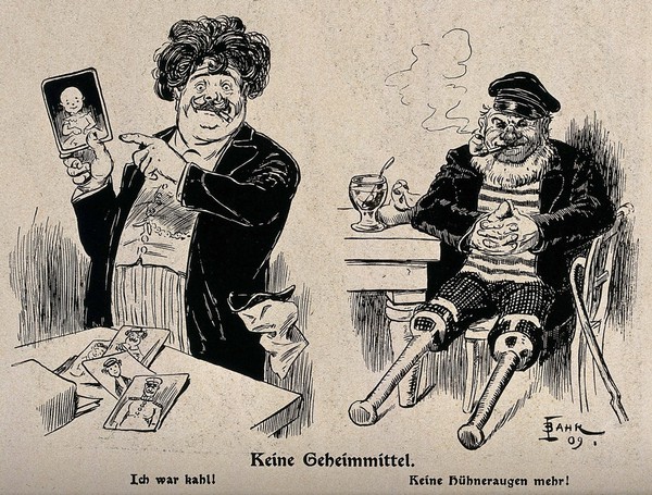 "No secret remedy": natural solutions to baldness and corns. Lithograph after J. Bahr, 1909.