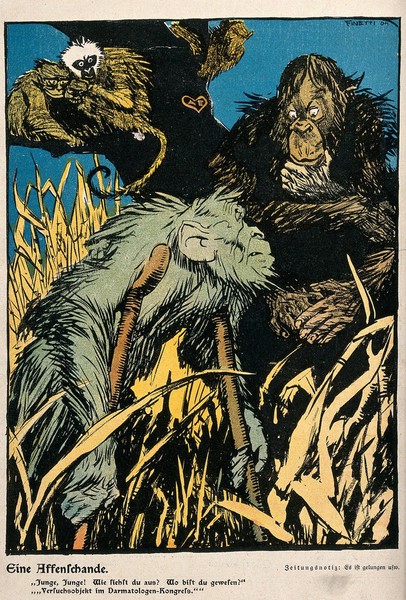 An unkempt ape on crutches tells his mates that he has returned from being an experimental animal at a congress of gastroenterologists. Colour lithograph after G. De Finetti, ca. 1904.