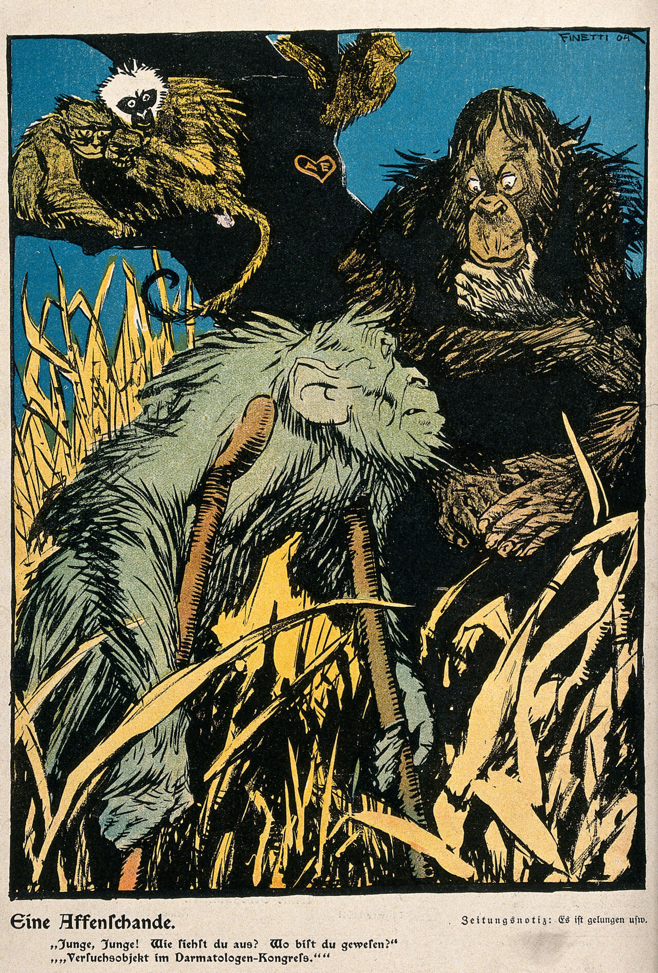An unkempt ape on crutches tells his mates that he has returned from being an experimental animal at a congress of gastroenterologists. Colour lithograph after G. De Finetti, ca. 1904., 1904, by Gino DeFinetti