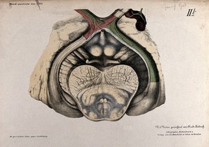 view Anatomical section of the brain showing the optic chiasma. Colour lithograph by F. Foedisch,  1875.