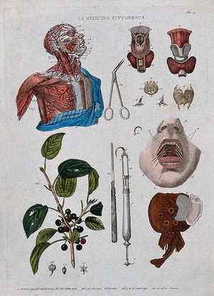 view Anatomy and botany; top left, dissected head and chest showing arteries; top right, larynx; bottom left, buckthorn plant; centre, surgical instruments; bottom right, electric ray fish. Coloured engraving, 1834-1837.