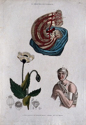 Anatomy, nursing and botany; top, arteries of the breast; bottom left, poppy; bottom right, man with bandaged head and arm. Coloured engraving, 1834-1837.