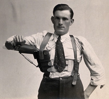 An arm support, part of a bodice worn over clothing, modelled by a standing man. Photograph, ca. 1920.