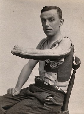 An arm support, part of a bodice to be worn beneath clothing, modelled by a seated man. Photograph, ca. 1920.