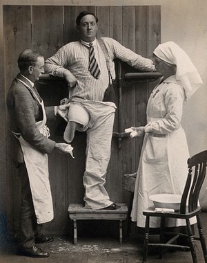 view A patient with one leg having plaster of paris applied to the stump, standing between a doctor and nurse. Photograph, ca. 1915.