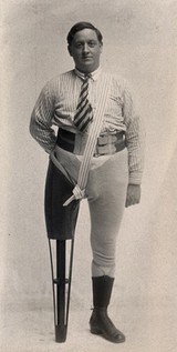 A man with a wooden leg prosthesis. Photograph, ca. 1915.