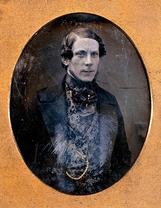 A man in a patterned waistcoat with a gold watch-chain. Photograph, 1840/1855.