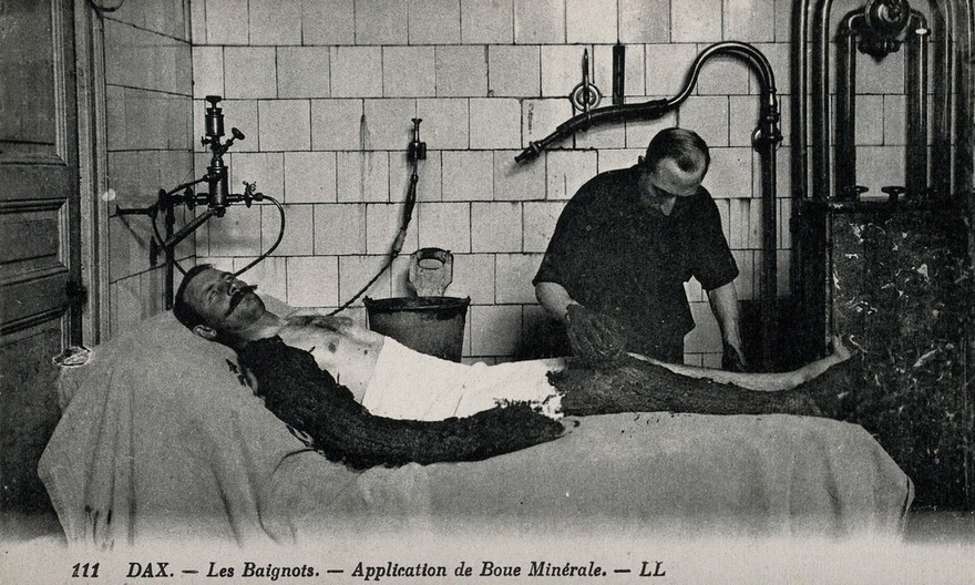 Dax, France: mud being applied on a patient of a thermal establishment. Photographic postcard, ca. 1920.