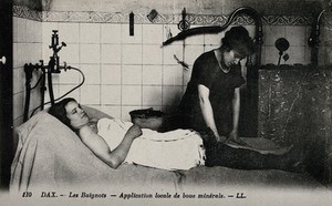 view Dax, France: mud being applied on the leg of a patient of a thermal establishment. Photographic postcard, ca. 1920.