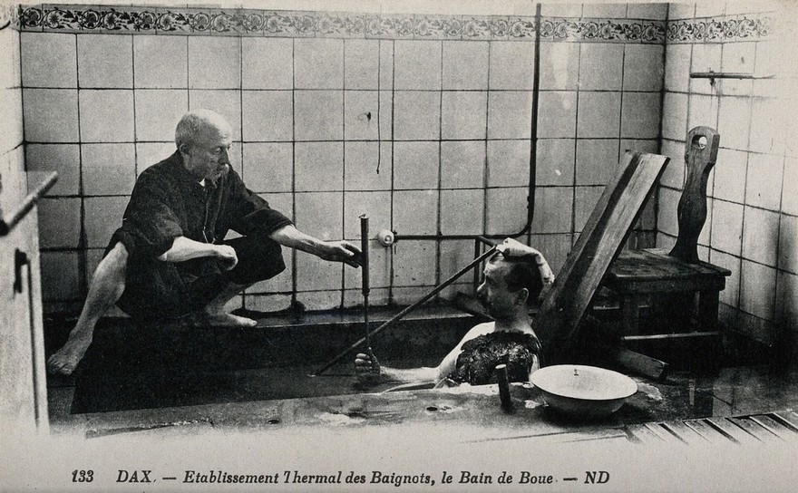 Dax, France: a patient in a mud bath, in a thermal establishment. Photographic postcard, ca. 1920.