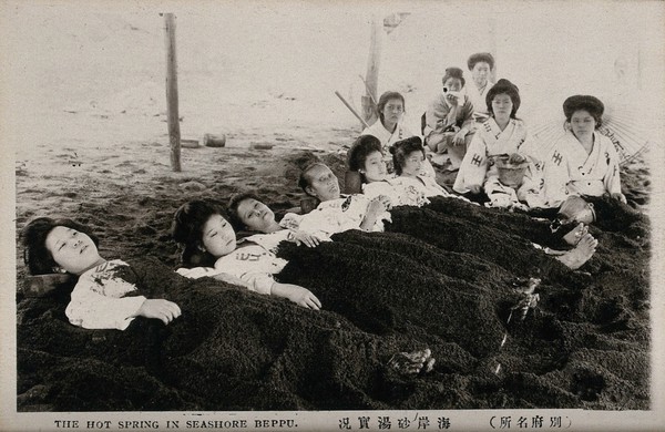 Beppu, Japan: women lying under the sand of the hot spring. Photographic postcard, ca. 1930.