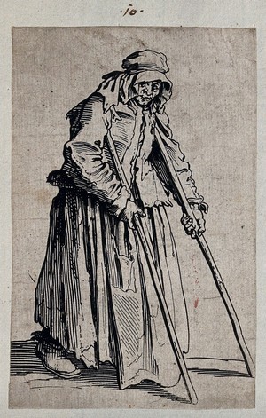 view One-eyed beggar woman. Etching with engraving by Jacques Callot, ca. 1622.