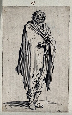 view Male beggar dressed in rags. Etching with engraving by Jacques Callot, ca. 1622.