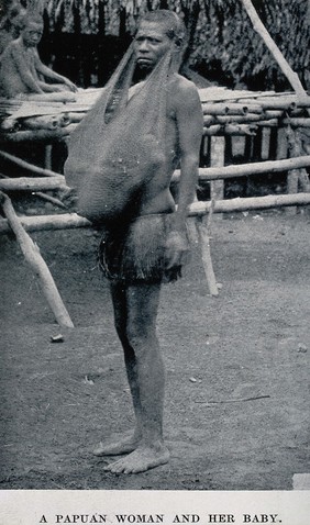 A Papuan woman holding her baby in a child carrier attached around her head. Halftone.