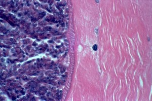 view Sarcocystosis: sarcocyst in skeletal muscle