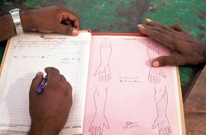 view Leprosy: impairment records