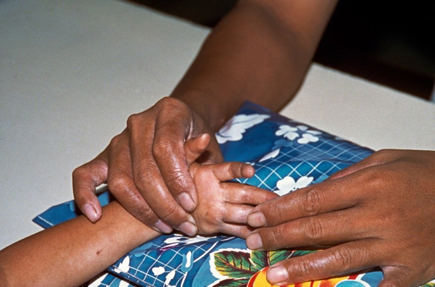 Leprosy: mobility exercise