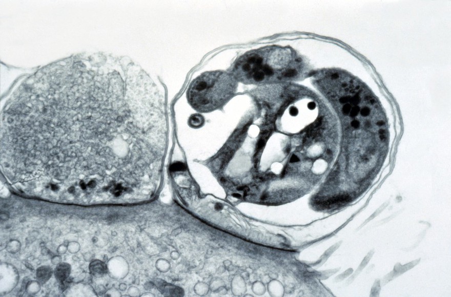 Gastrointestinal tract: cryptosporidiosis and HIV