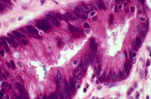 Rectum