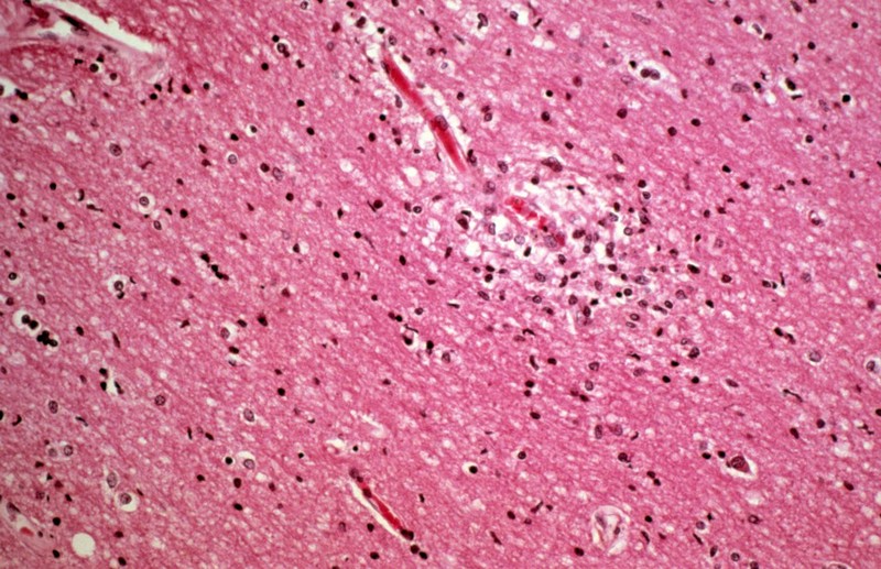 洋楽 MALARIA! EMOTION Malaria! / Emotion [YX-7323-AX] | MOKUME RECORDS