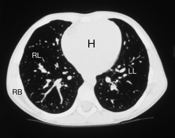 Medical imaging: normal CT scan
