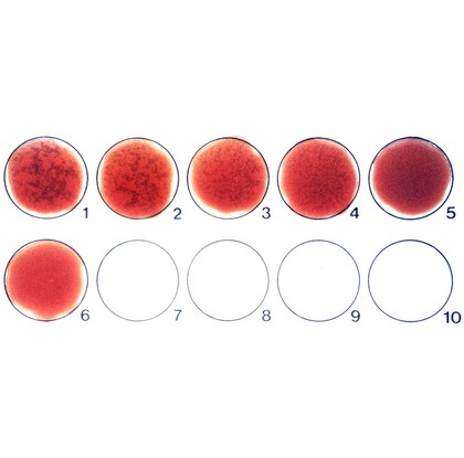 Card agglutination test for trypanosomiasis
