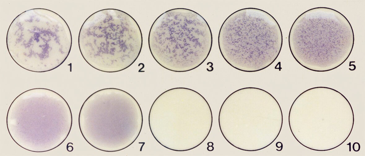 Card agglutination test for trypanosomiasis Collection