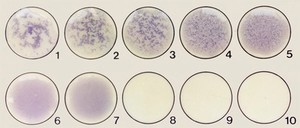 view Card agglutination test for trypanosomiasis