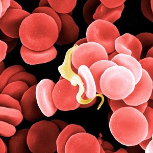 view Trypanosome among blood cells