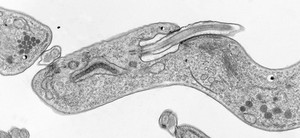 view <i>Trypanosoma brucei brucei</i>