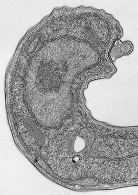 <i>Trypanosoma brucei brucei</i>