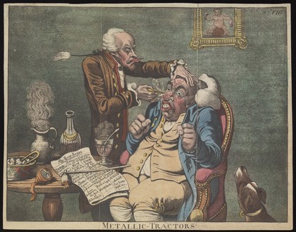 An operator treating the carbuncled nose of an obese patient with "Perkins's tractors". Coloured aquatint after J. Gillray, 1801.