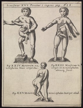 Three human figures, each with superfluous body parts growing from their bodies. Engraving, 16--.