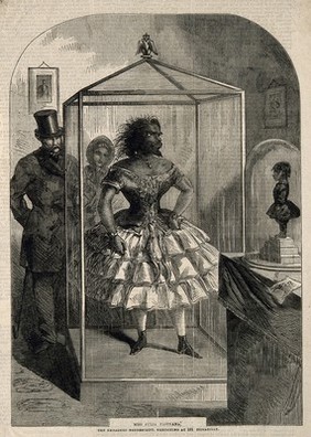 Julia Pastrana, a bearded woman, embalmed. Wood engraving, 1862.