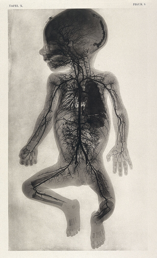 No text description is available for this image