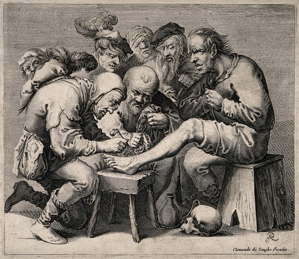 An operator treating a patient's foot; a crowd of people is gathered around watching the work. Line engraving by P. Quast.