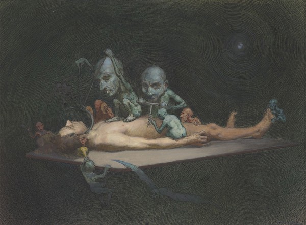 An unconscious naked man lying on a table being attacked by little demons armed with surgical instruments; representing the effects of chloroform on the human body. Watercolour by R. Cooper.