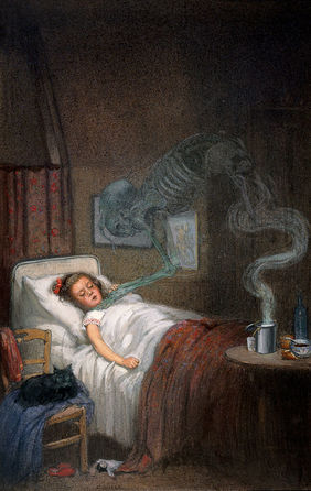 A ghostly skeleton trying to strangle a sick child; representing diphtheria. Watercolour by R. Cooper.