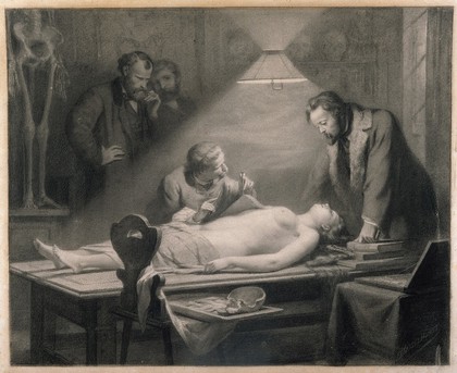 The dissection of a young, beautiful woman directed by J. Ch. G. Lucae (1814-1885) in order to determine the ideal female proportions. Chalk drawing by J. H. Hasselhorst, 1864.