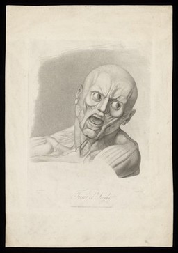 An écorché face showing the muscles involved in the expression of terror. Stipple engraving by H. Singleton (?) after G.T. Stubbs after G. Stubbs, 1815.